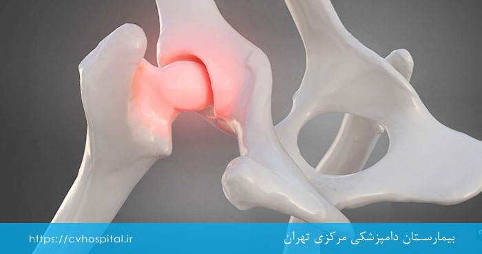 درمان هیپ دیسپلازی در سگ
